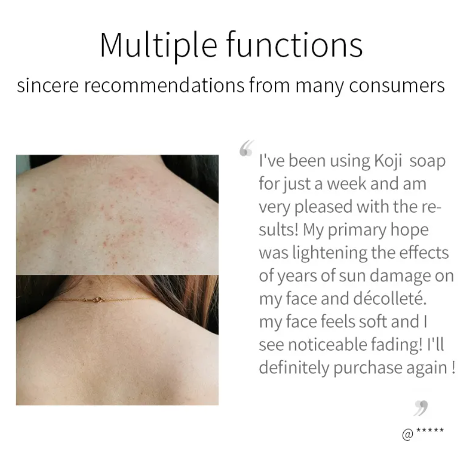 Kojic Acid Skin Brightening Facial Soap